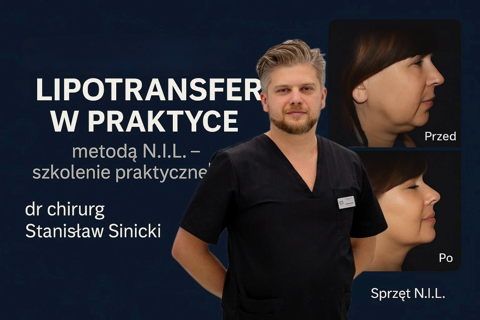 Zabieg Lipotransfer - szkolenie